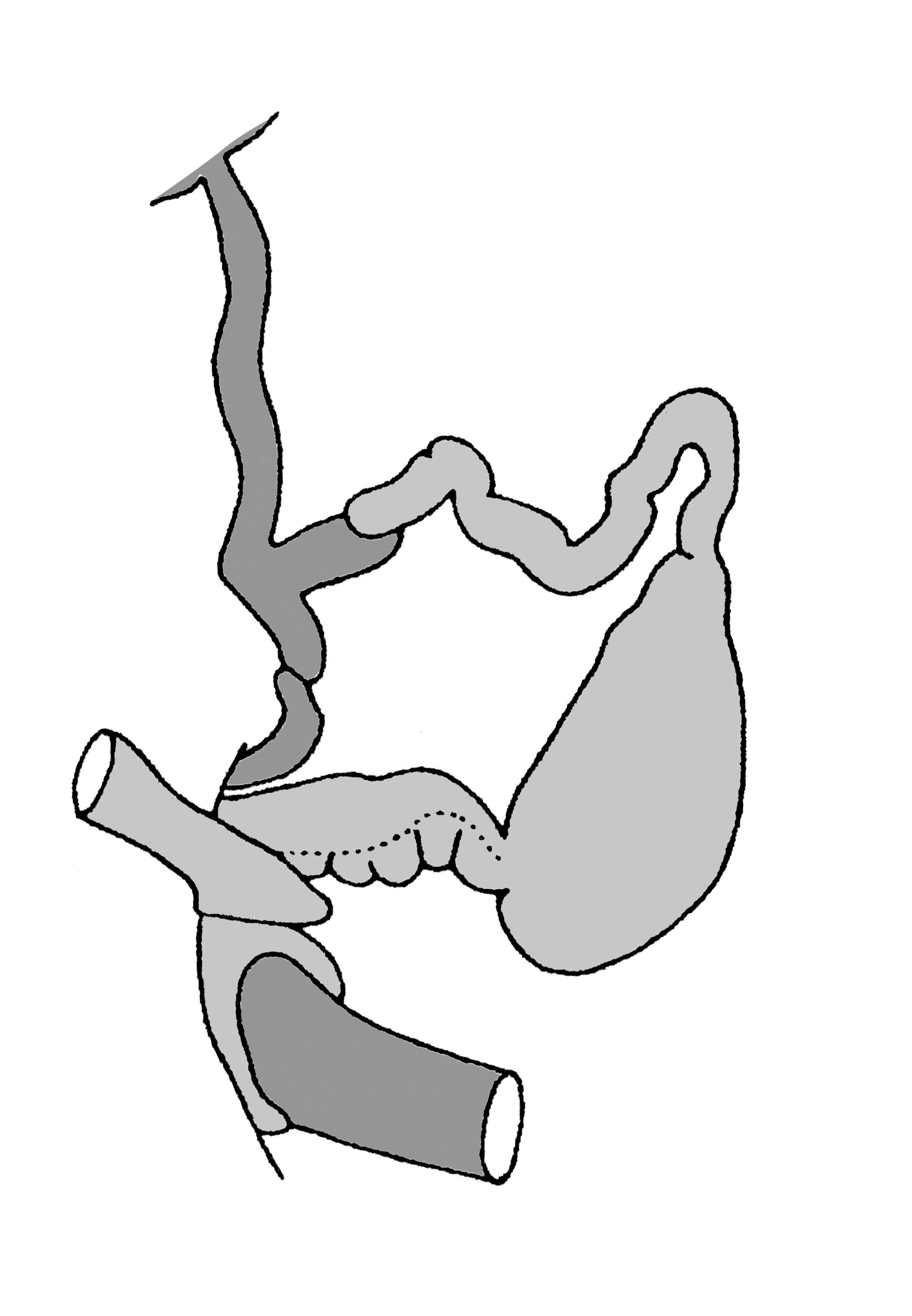             Diplosolenodes occidentalis:  genitalia-part of the posterior   genitalia .  (Photo: © T.W. Thome, modified by K. Weigel, University of   Florida)   
