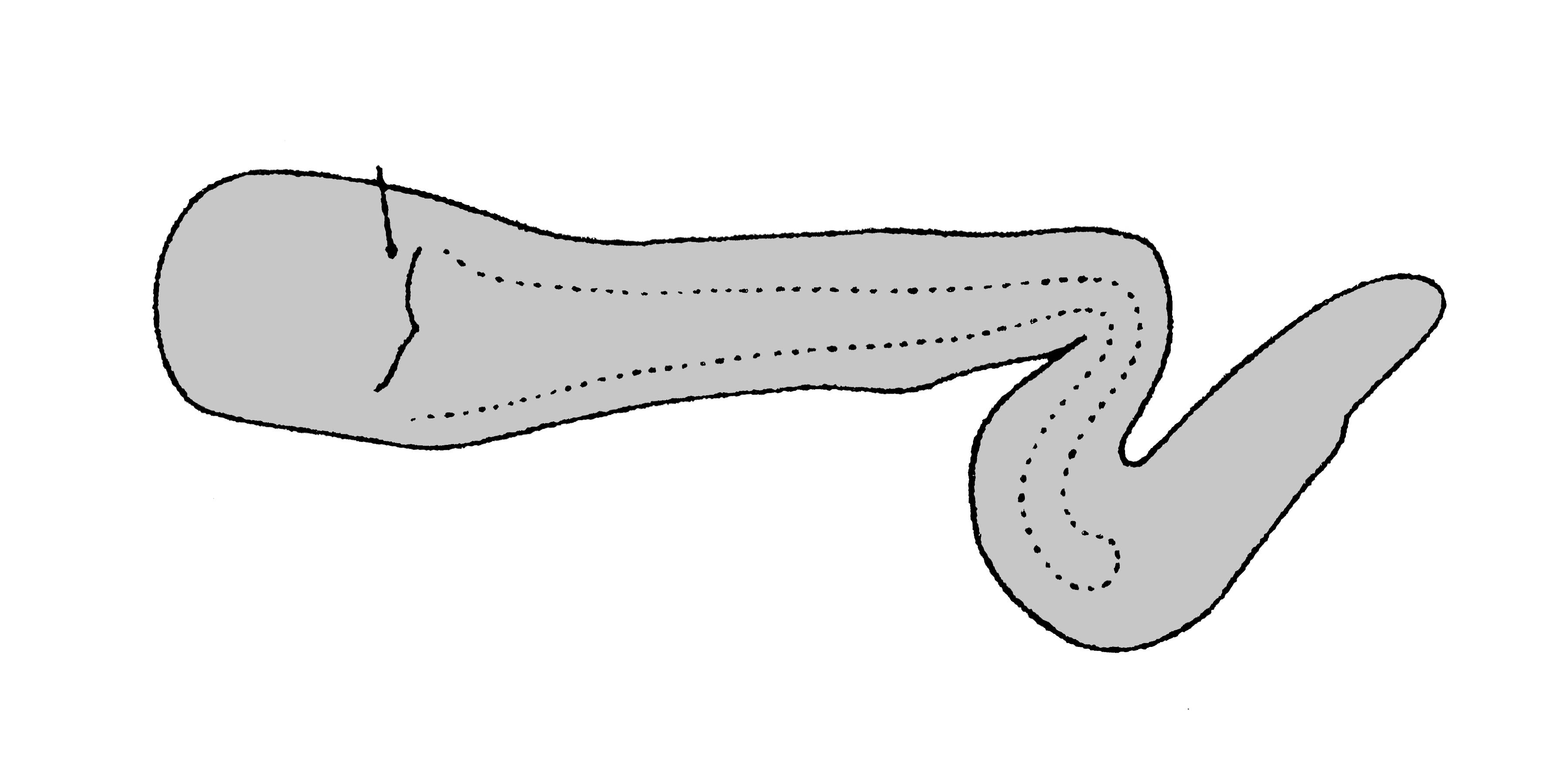             Diplosolenodes occidentalis:  genitalia-pedal gland .  (Photo:   © T.W. Thome, modified by K. Weigel, University of Florida)   
