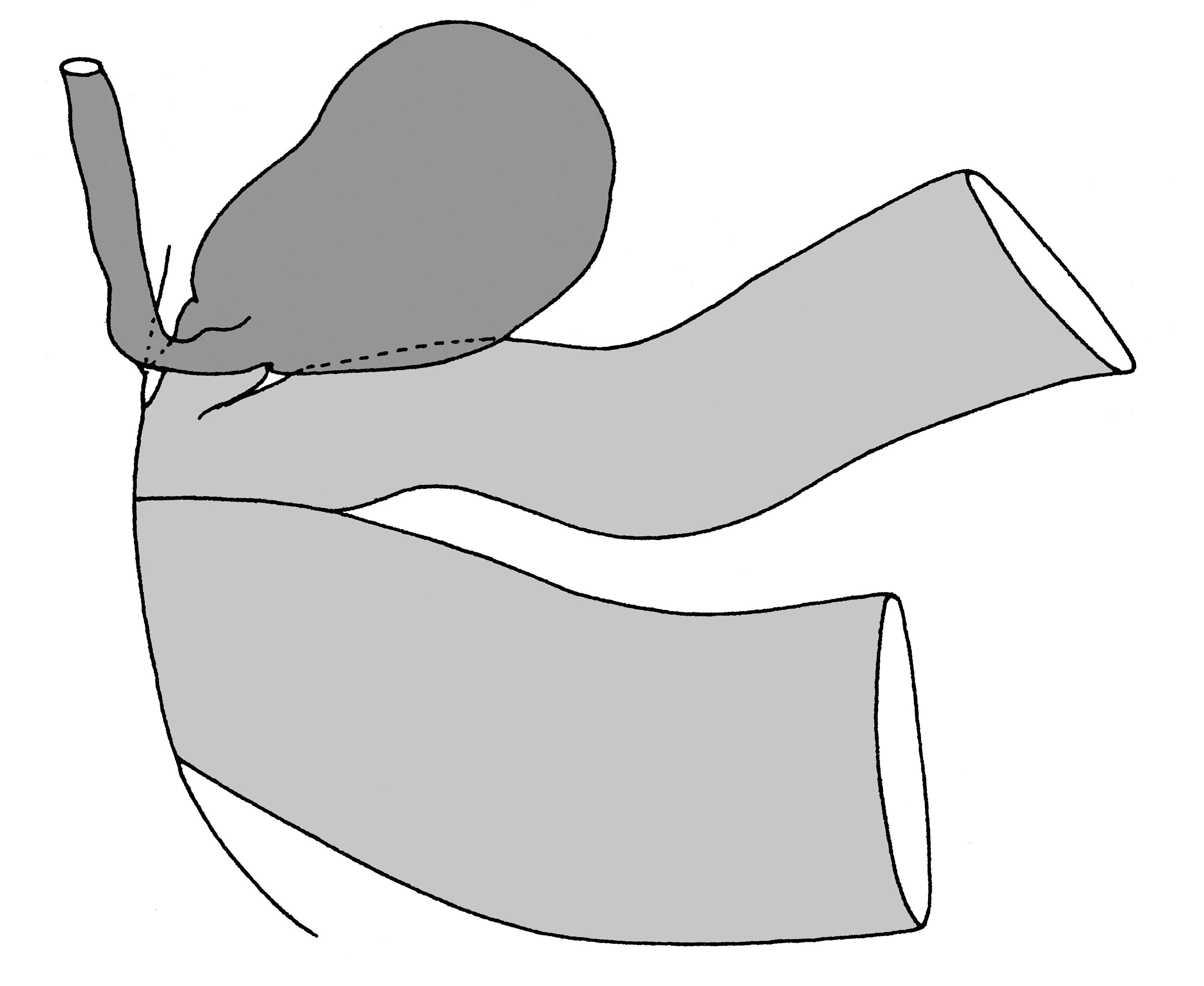             Sarasinula dubia:  genitalia-part of the posterior genitalia .    (Photo: © T.W. Thome, modified by K. Weigel, University of   Florida)   