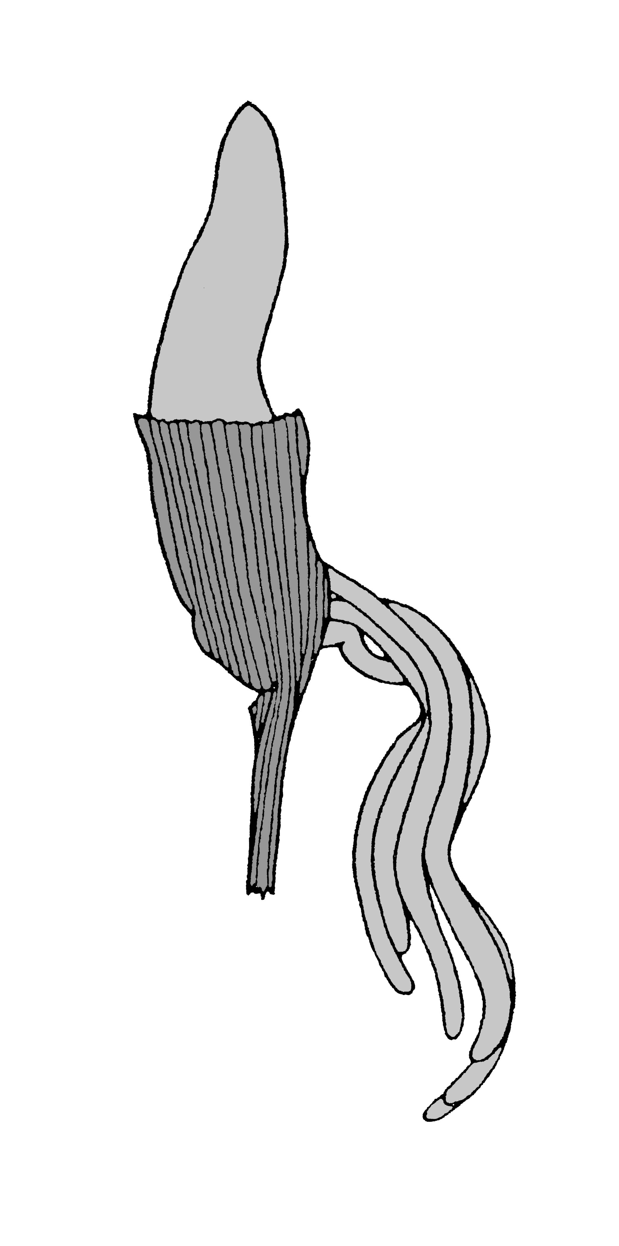             Sarasinula dubia:  genitalia-penial gland .  (Photo: © T.W.   Thome, modified by K. Weigel, University of Florida)   