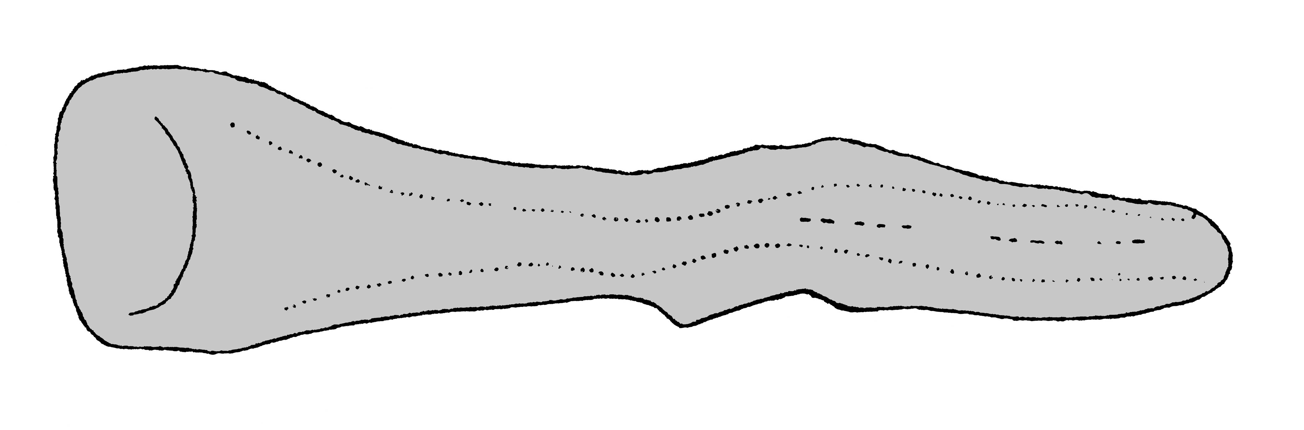             Sarasinula dubia:  genitalia-pedal gland .  (Photo: © T.W.   Thome, modified by K. Weigel, University of Florida)   