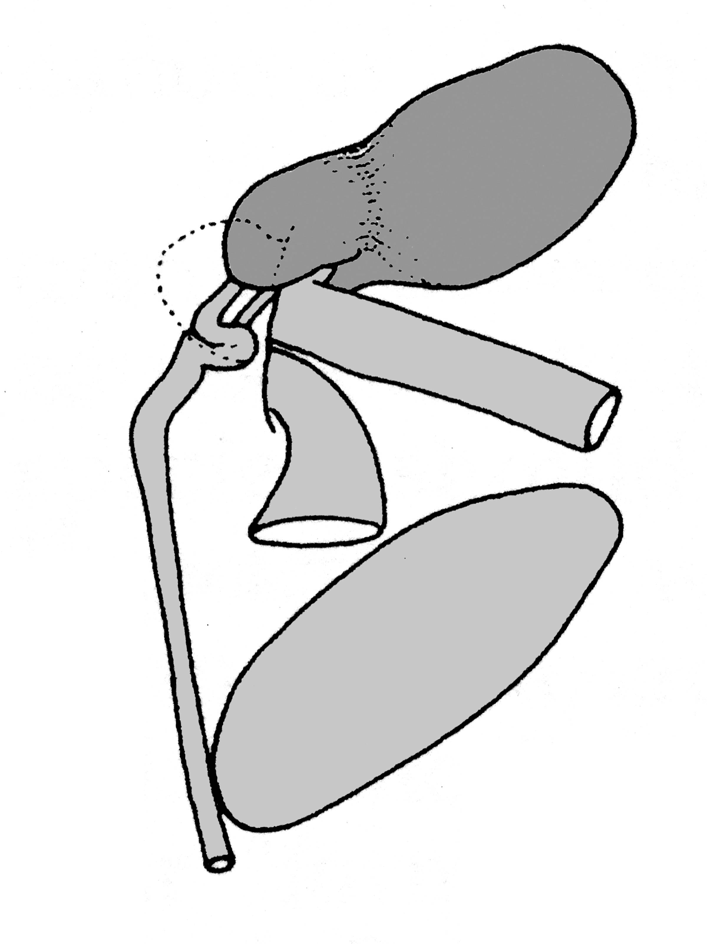             Belocaulus angustipes:  genitalia-part of the posterior   genitalia .  (Photo: © T.W. Thome, modified by K. Weigel, University of   Florida)   