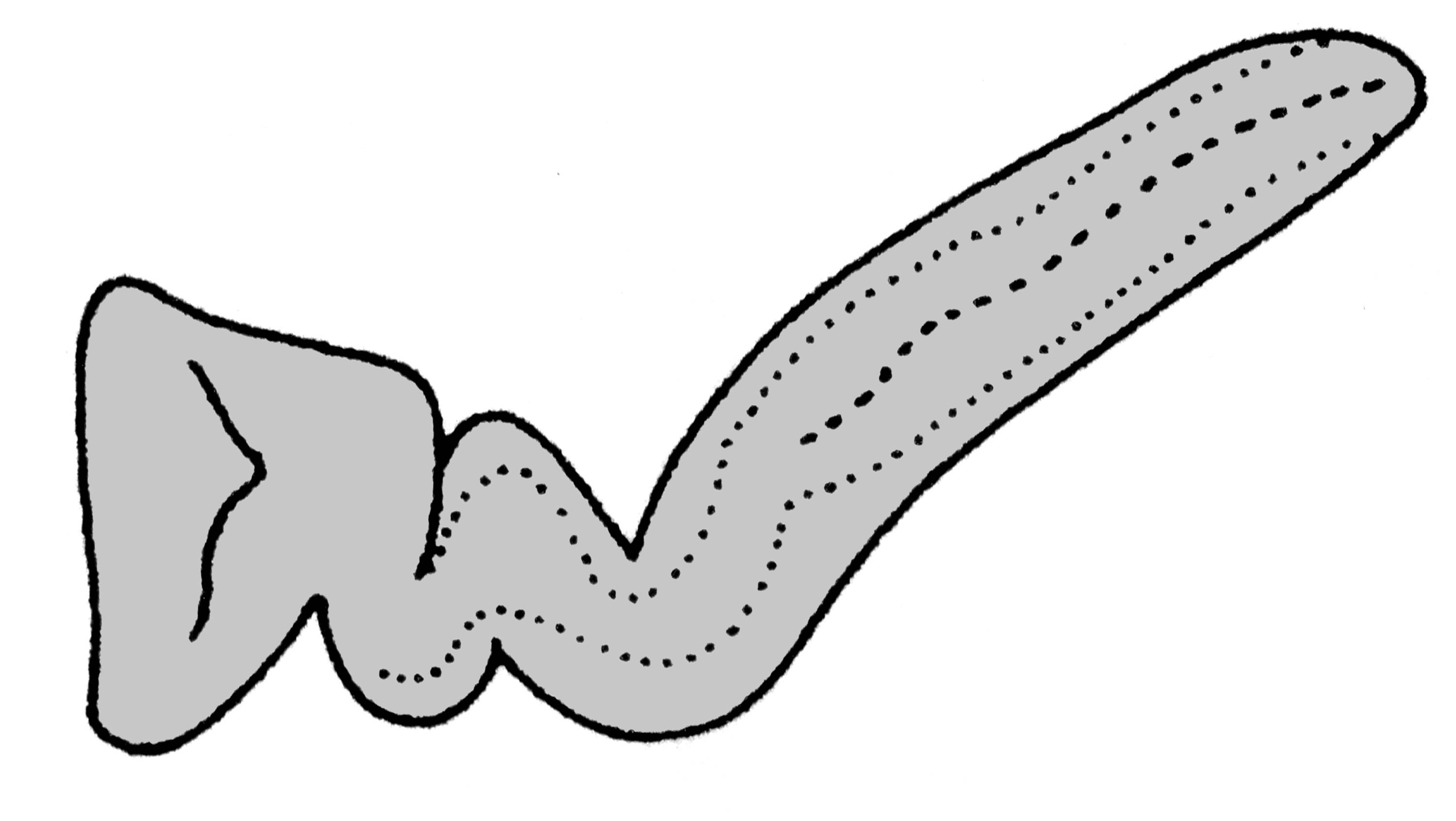             Belocaulus angustipes:  genitalia-pedal gland .  (Photo: ©   T.W. Thome, modified by K. Weigel, University of Florida)   
