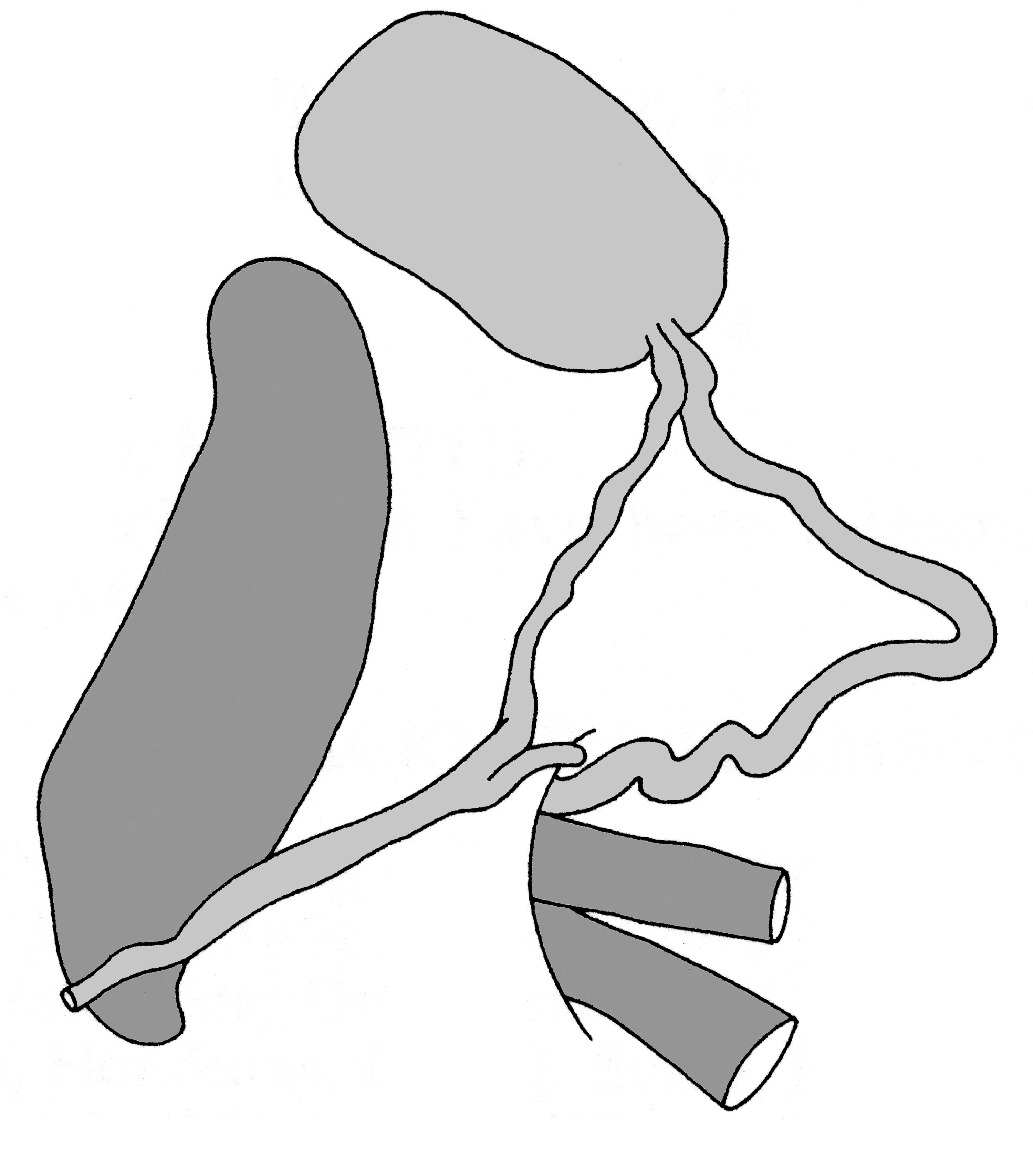             Vaginulus alte:  genitalia-posterior part of the genitalia .    (Photo: © T.W. Thome, modified by K. Weigel, University of   Florida)   